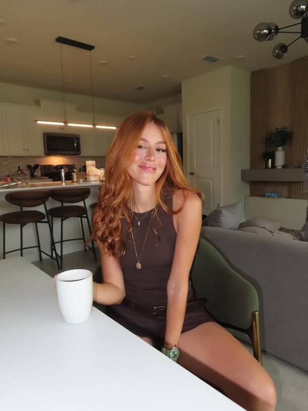 FOTO Posebna ljepota: Milijuni ljudi obožavaju njezine pjegice