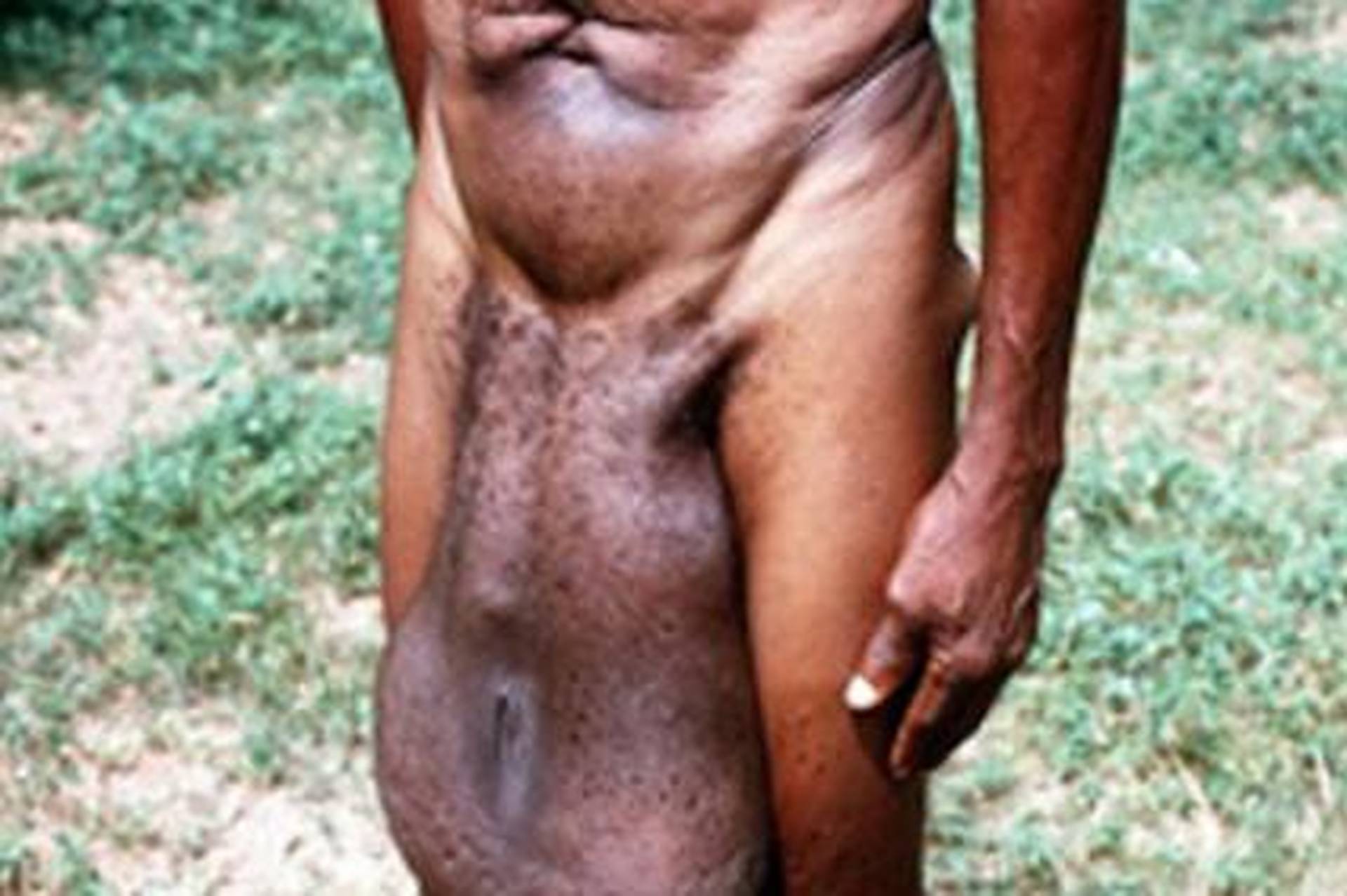 Maladie des feuilles du figuier - engezni.com.