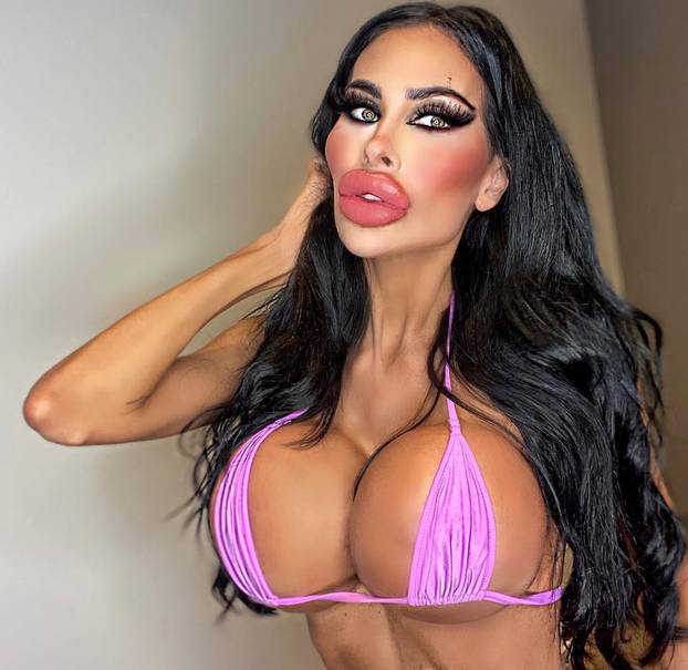 FOTO Potrošila više od 100 tisuća eura kako bi izgledala kao 'ljudska barbika' - Liječnici zgroženi