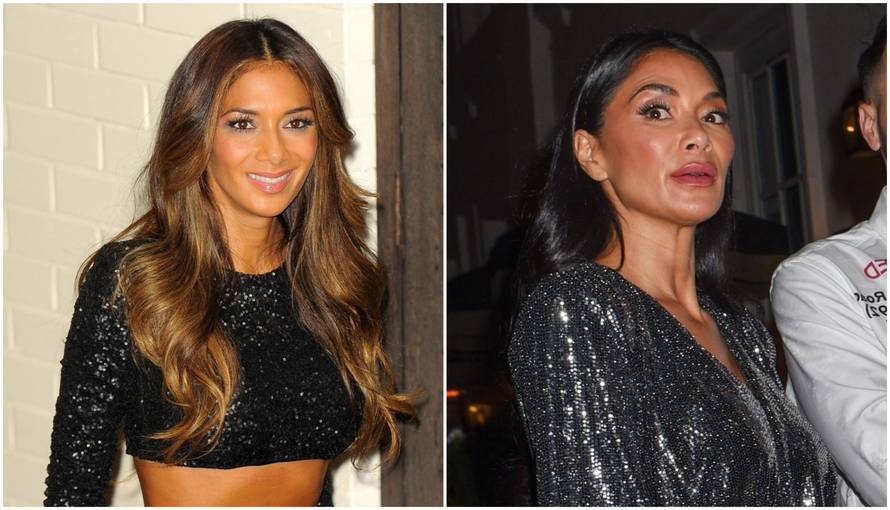 Slavnu pjevačicu uhvatili su u izlasku: Uništila je lijepo lice...