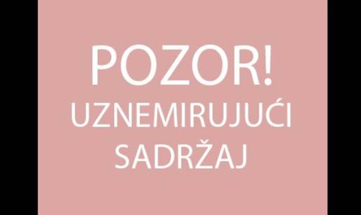 Istiskivao joj je 'lažni' silikon: Molim vas, nemojte si to raditi