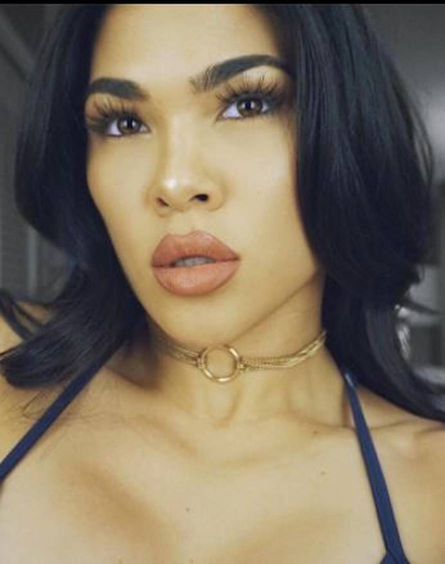 Pretučena UFC-ova ljepotica, sumnjaju  na obiteljsko nasilje