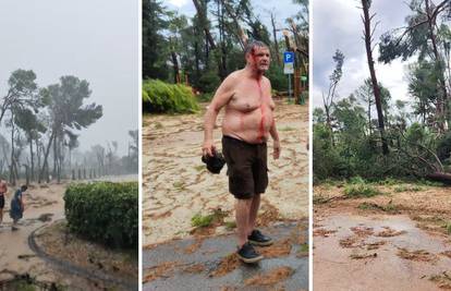 Sociolog Lalić ozlijeđen u oluji u Splitu: 'Spašavao sam psa, a sada imam šavove na glavi'