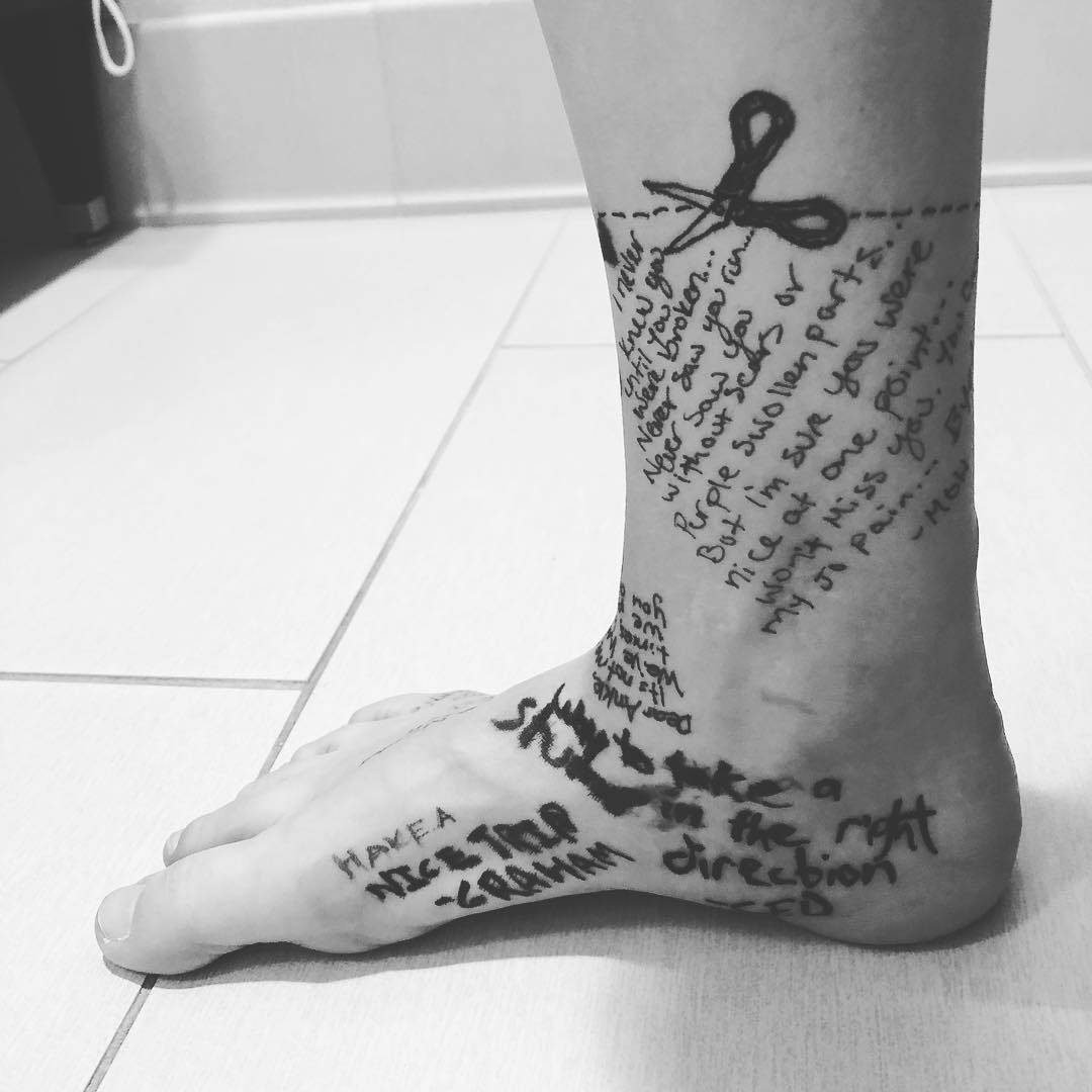 Amputirala nogu i napisala joj pismo: 'Nije do mene, već tebe'