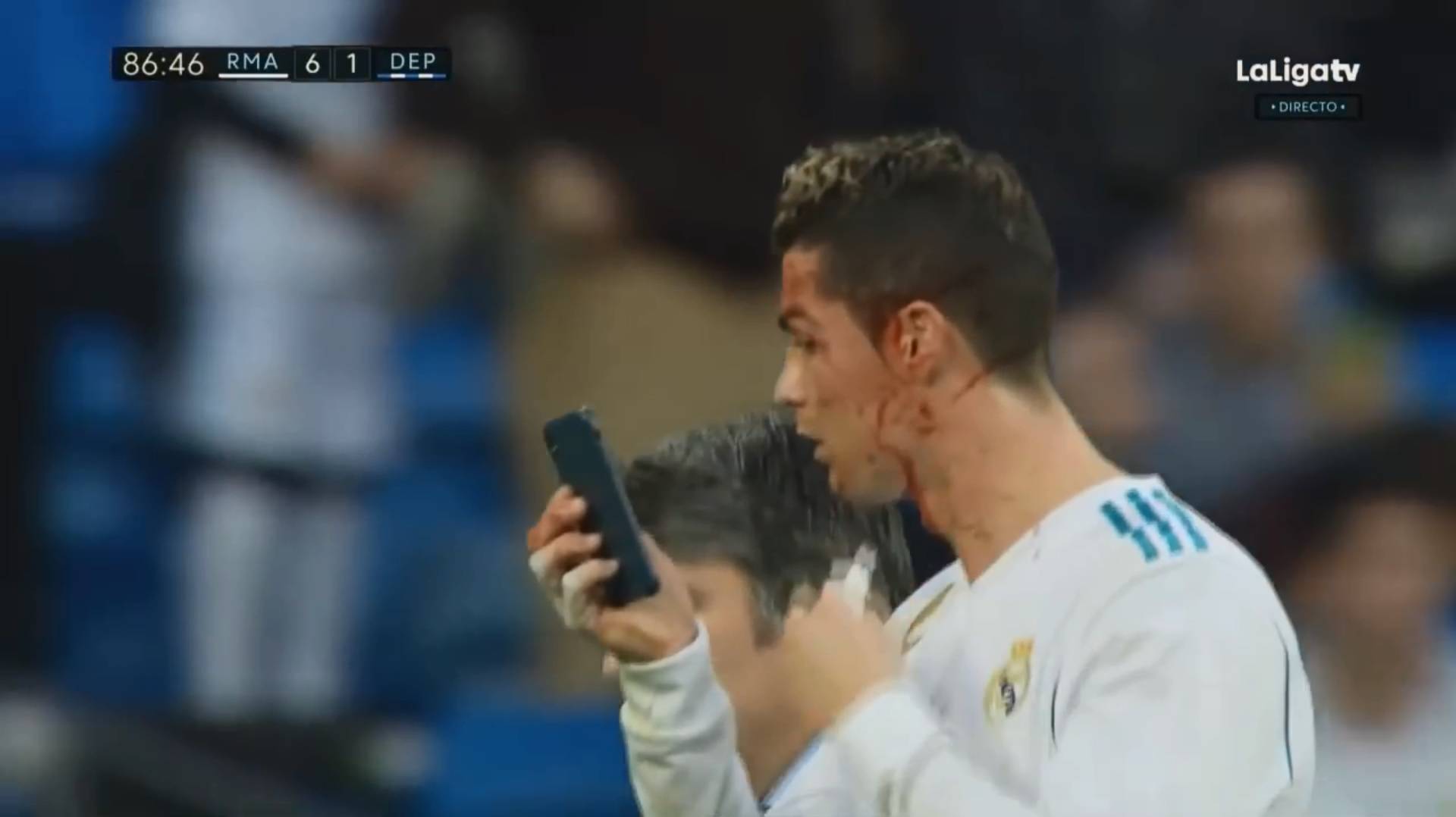 Ronaldo dobio nogom u glavu pa se krvav ogledao u mobitelu