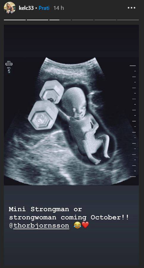 Thor i žena čekaju dijete: Na fotki ultrazvuka beba drži uteg