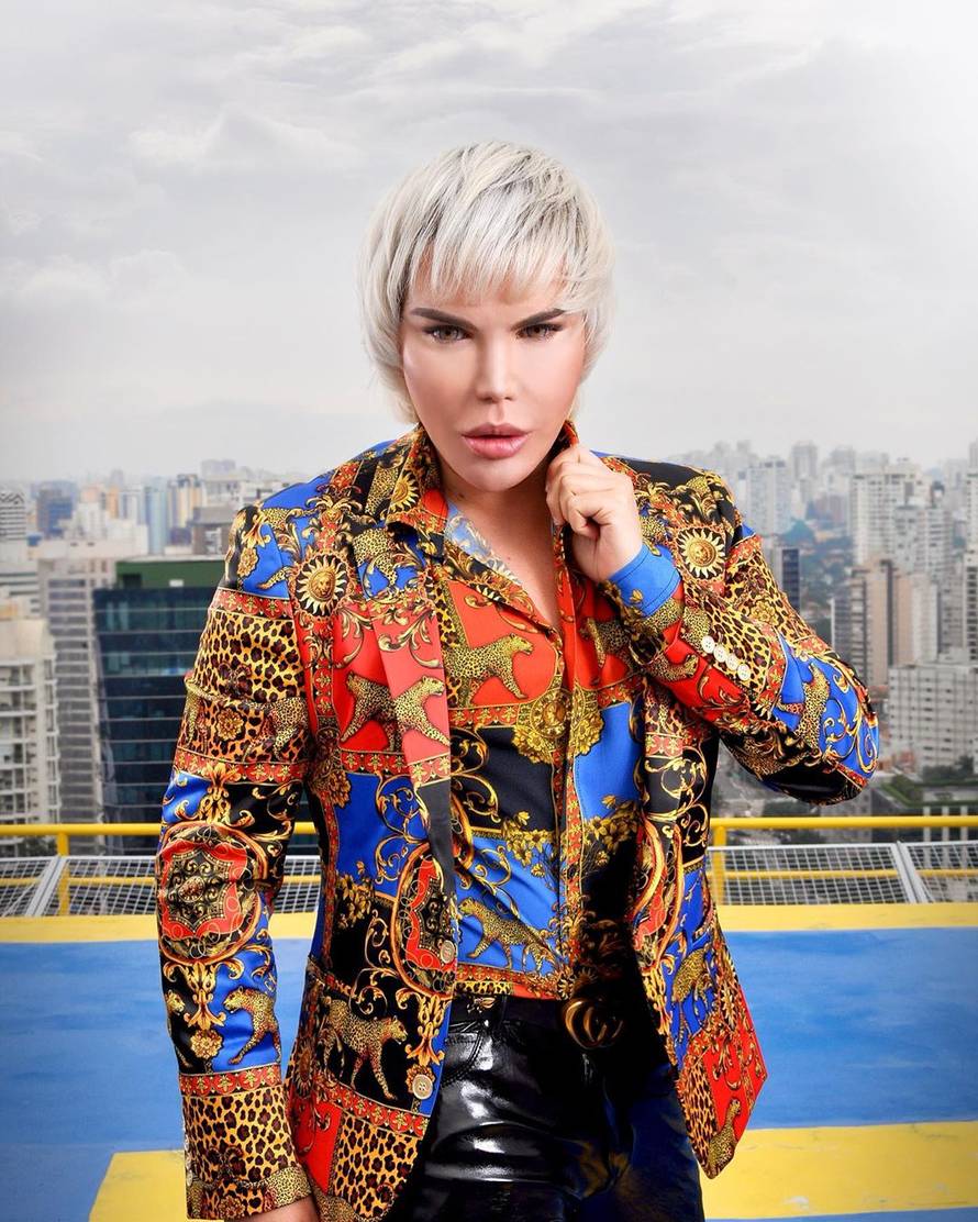 Ljudski Ken je postao Barbie: Ugradio izblajhane ekstenzije