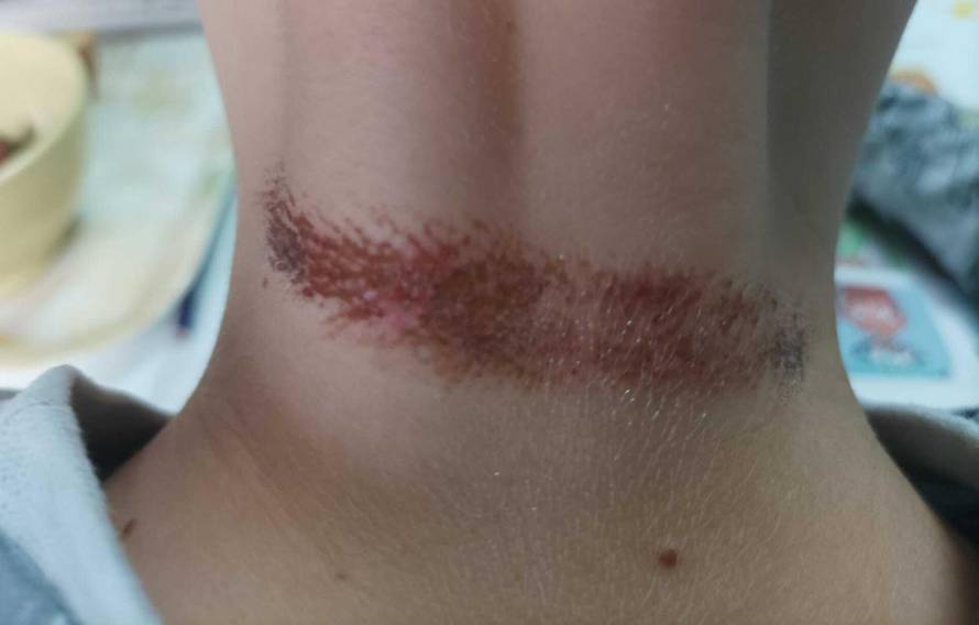 Užasan slučaj vršnjačkog nasilja u Zagrebu: 'Sinu su mi stavili omču oko vrata i vukli su ga'