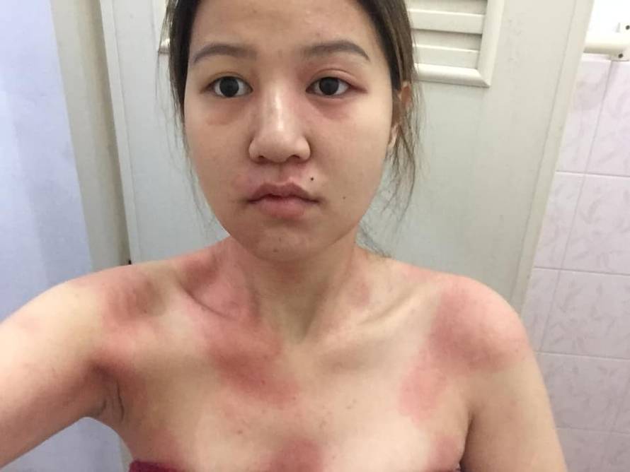 'Stanje je nepodnošljivo, zbog smoga svi krvarimo i kašljemo'