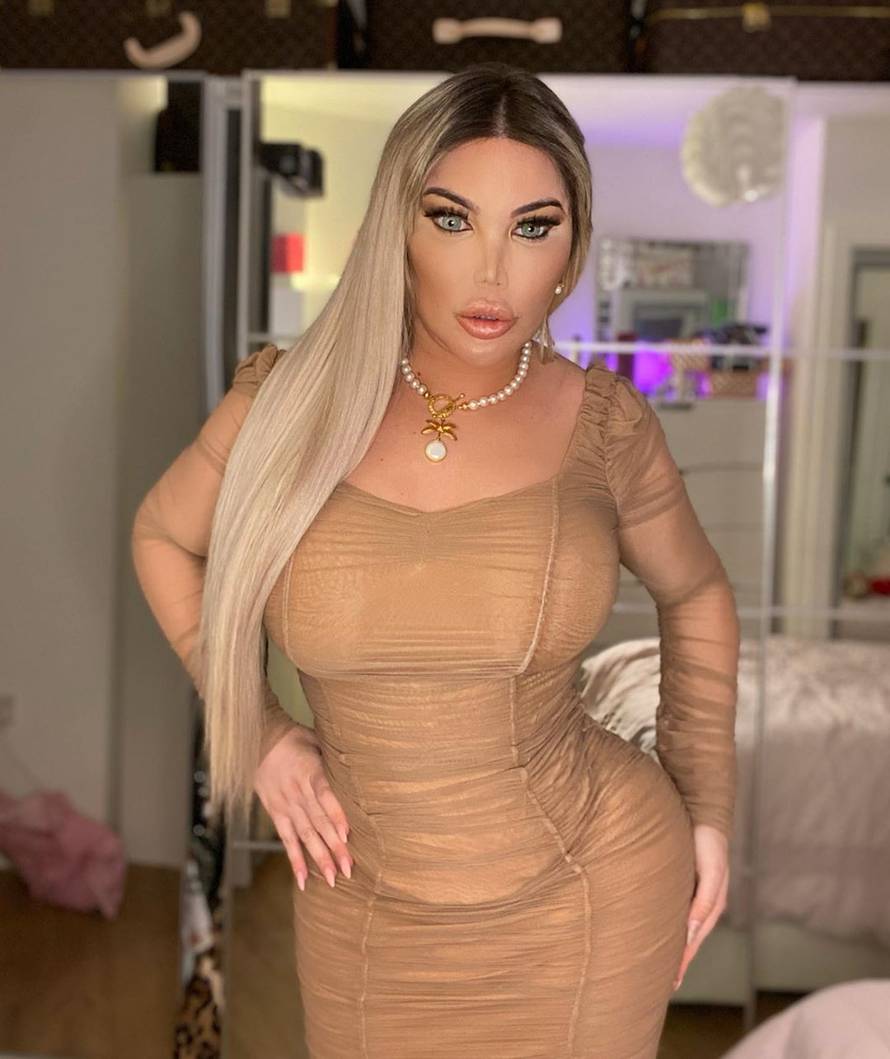 Opleli po bivšem Kenu: Izgledaš kao iz horora. Što ti je s očima?