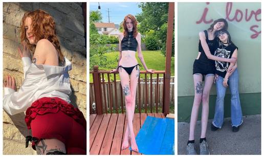 FOTO Visoka je 208 cm, a noge duže od 135: Ova influencerica ne stane ni u krevet ni u auto...