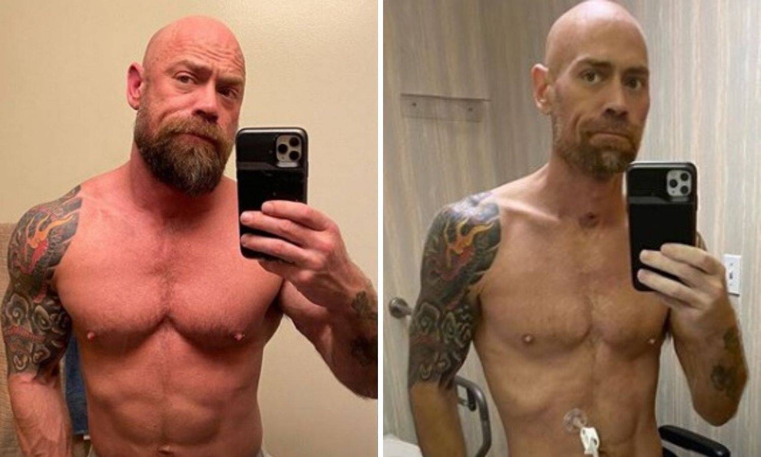 Prije i poslije korone: Bio je u bolnici 6 tjedana, izgubio 23 kg