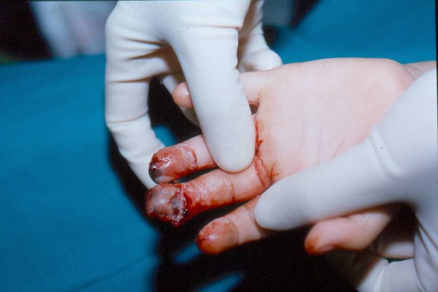 Evo zašto su zabranili petarde: Stravične snimke iz Klaićeve