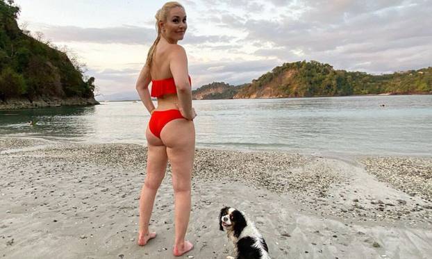 FOTO Vonn u štiklama pokazala isklesano tijelo pa šokirala: 'Gležanj mi je i dalje slomljen'