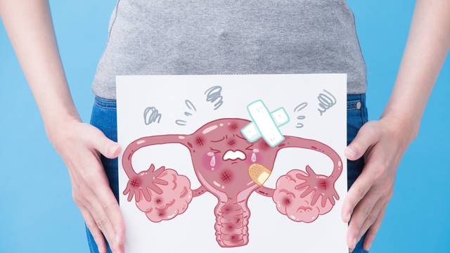 U Hrvatskoj je u godini dana umrlo 308 žena od raka jajnika: 'To nisu samo ženske stvari'