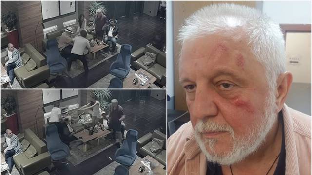 Redatelj nakon Bjelogrlićevog napada: Divljački čin! Psovao me i udarao, nisam ništa mogao