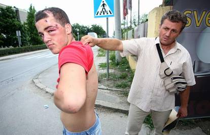Zagreb: Kaznit će policajca koji je tukao mladića (15)