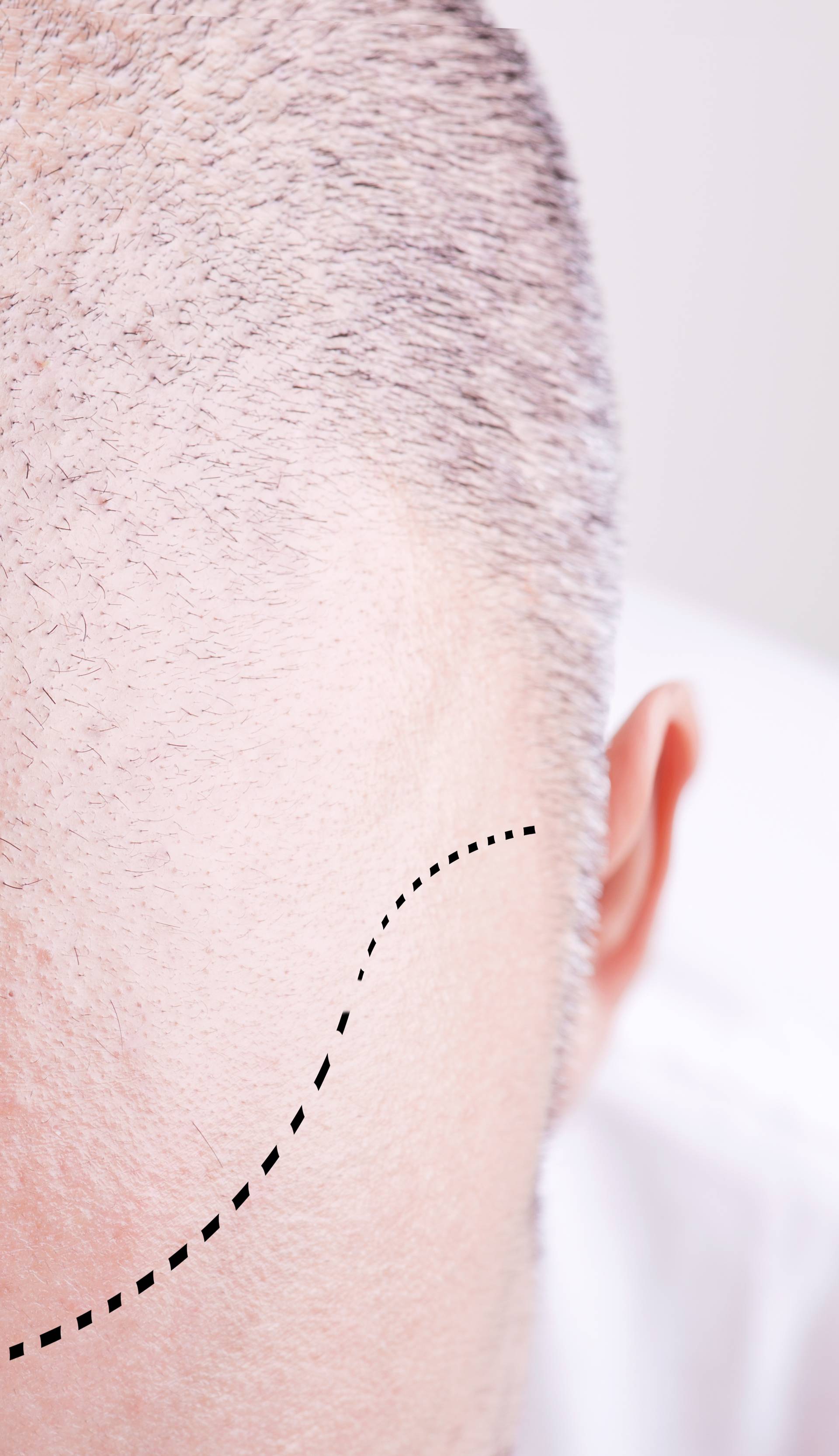 Švicarski dermatolog otkriva metodu za bolji rast kose