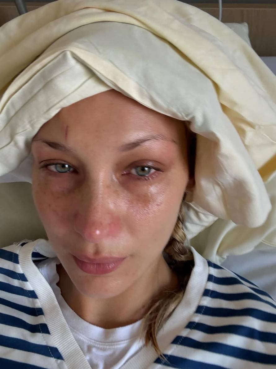 Bella Hadid: Morala sam odbiti poslove radi bolesti. Zbog toga sam se osjećala zamjenjivo...