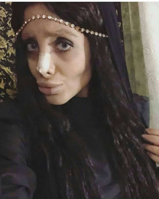 FOTO Sjećate se iranske 'zombi Angeline Jolie'? Ovako izgleda zapravo, a evo i zašto je nestala
