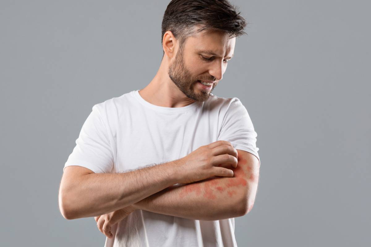 Povodom Svjetskog dana psorijaze podsjećamo na važnosti pravilne brige o koži