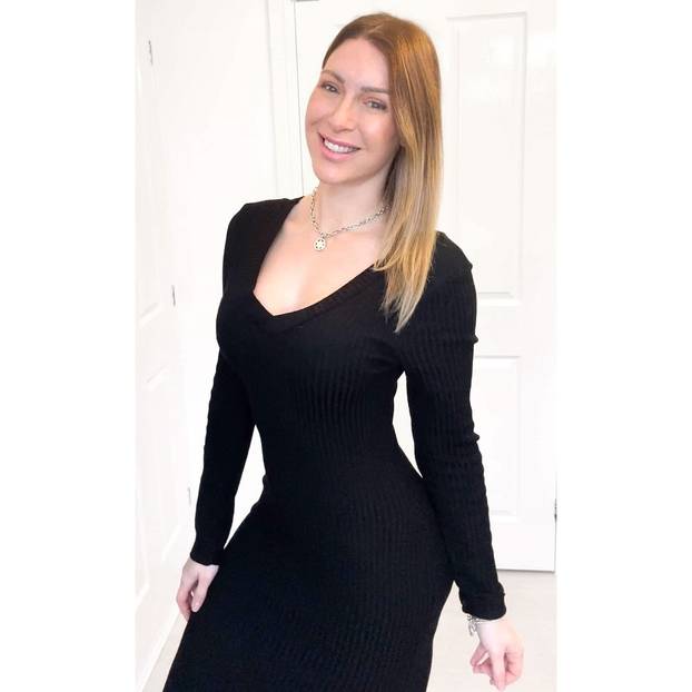 Dosadio joj izgled barbike pa se za 140.000 € 'popravila': Evo kako je izgledala prije zahvata