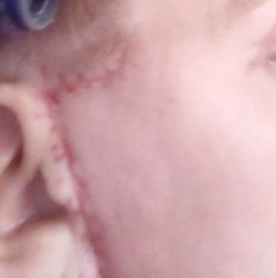 Estetski kirurg iz Zagreba htio ušutkati žene koje su se žalile na njega, stigla mu opomena!