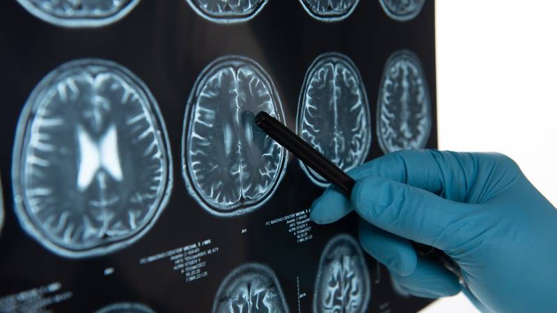 Znanost objasnila - evo što psihoaktivne biljke rade mozgu