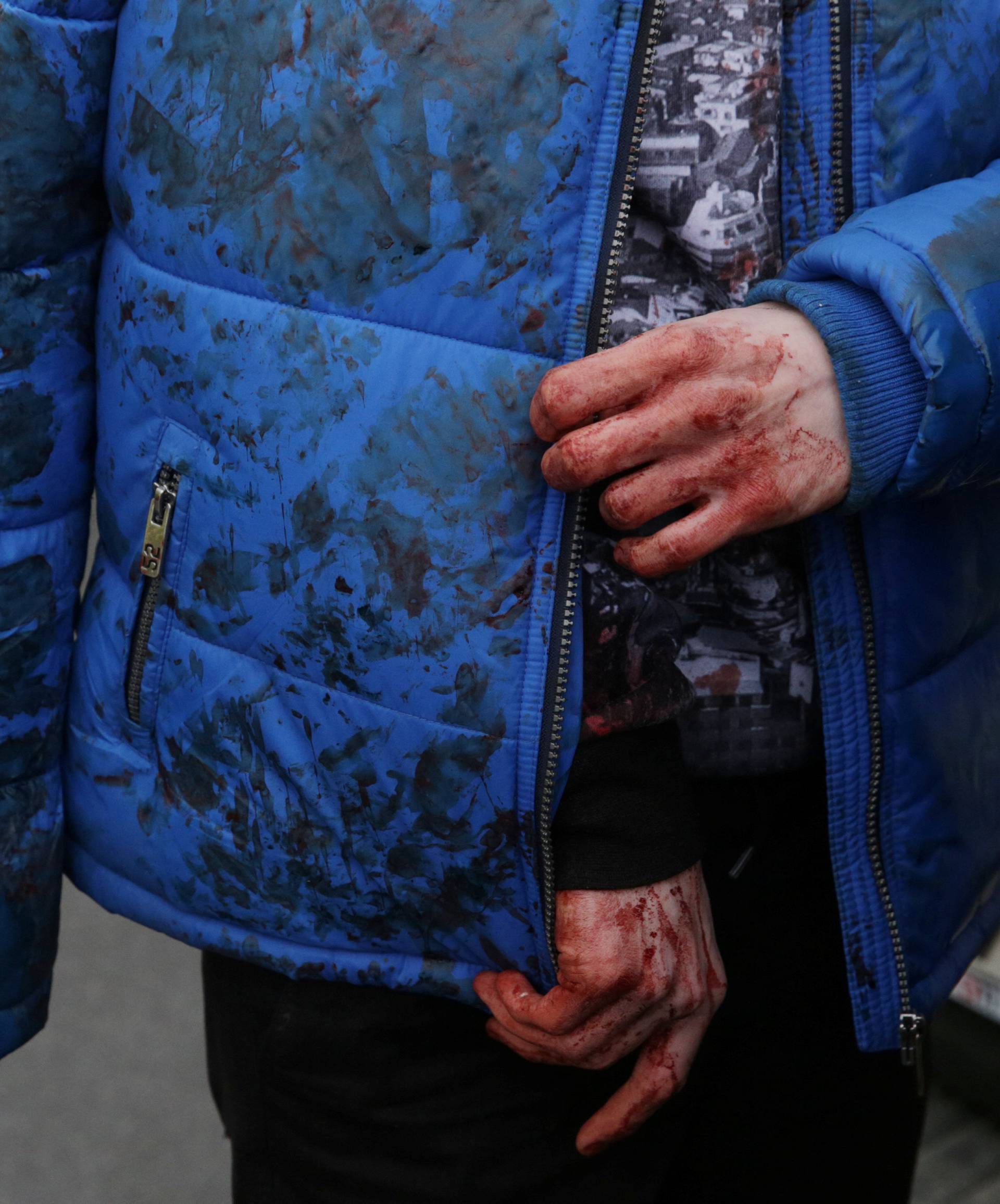 An iniured person walks outside Sennaya Ploshchad metro station following explosions in two train carriages at metro stations in St. Petersburg