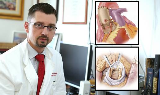 Rekonstruiraju srčane zaliske: Pacijenti sedmi dan idu kući...