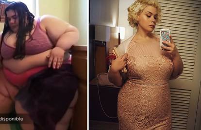 Imala je 300 kg, život joj je bio u opasnosti: Sad je druga žena
