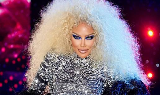 Šuput i ostale zvijezde: Kako izgledaju bez filtera i nakon 'peglanja'. Pogledajte fotke!