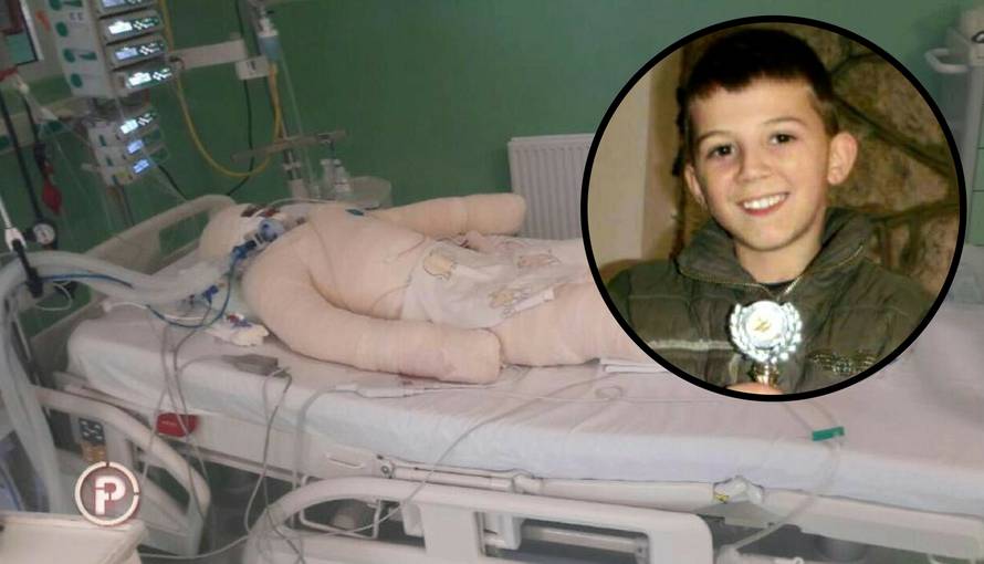 Izgorjelo mu 70% tijela: Meho je nakon operacija opet u školi