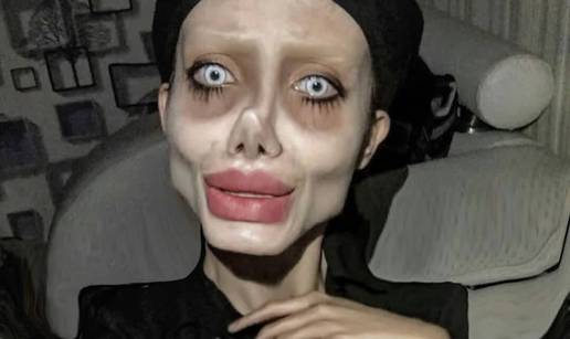 FOTO Sjećate se iranske 'zombi Angeline Jolie'? Ovako izgleda zapravo, a evo i zašto je nestala