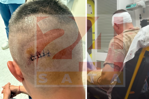 Pogledajte galeriju: Privođenje napadača na Slovence iz Umaga