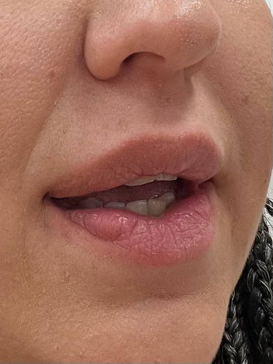 Estetski kirurg iz Zagreba htio ušutkati žene koje su se žalile na njega, stigla mu opomena!