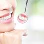 Healthy woman teeth and dentist mouth mirror