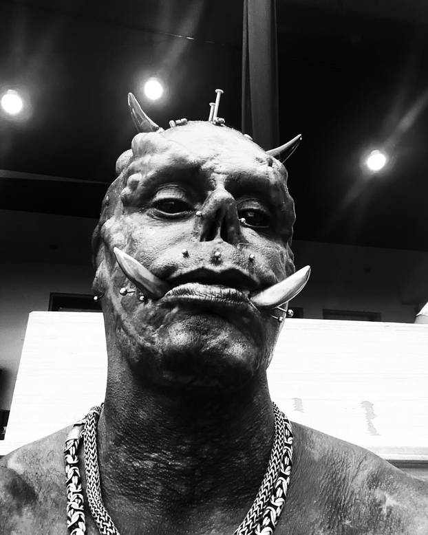 FOTO Šokantno! Dao je ukloniti prste kako bi imao kandže. I tu ne staje. Ovako je izgledao prije