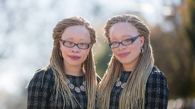 Twins With Albinism Wear Their Condition With Style