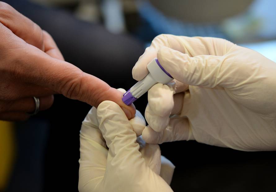 HIV quick test at the Berliner Aids Hilfe e.v.