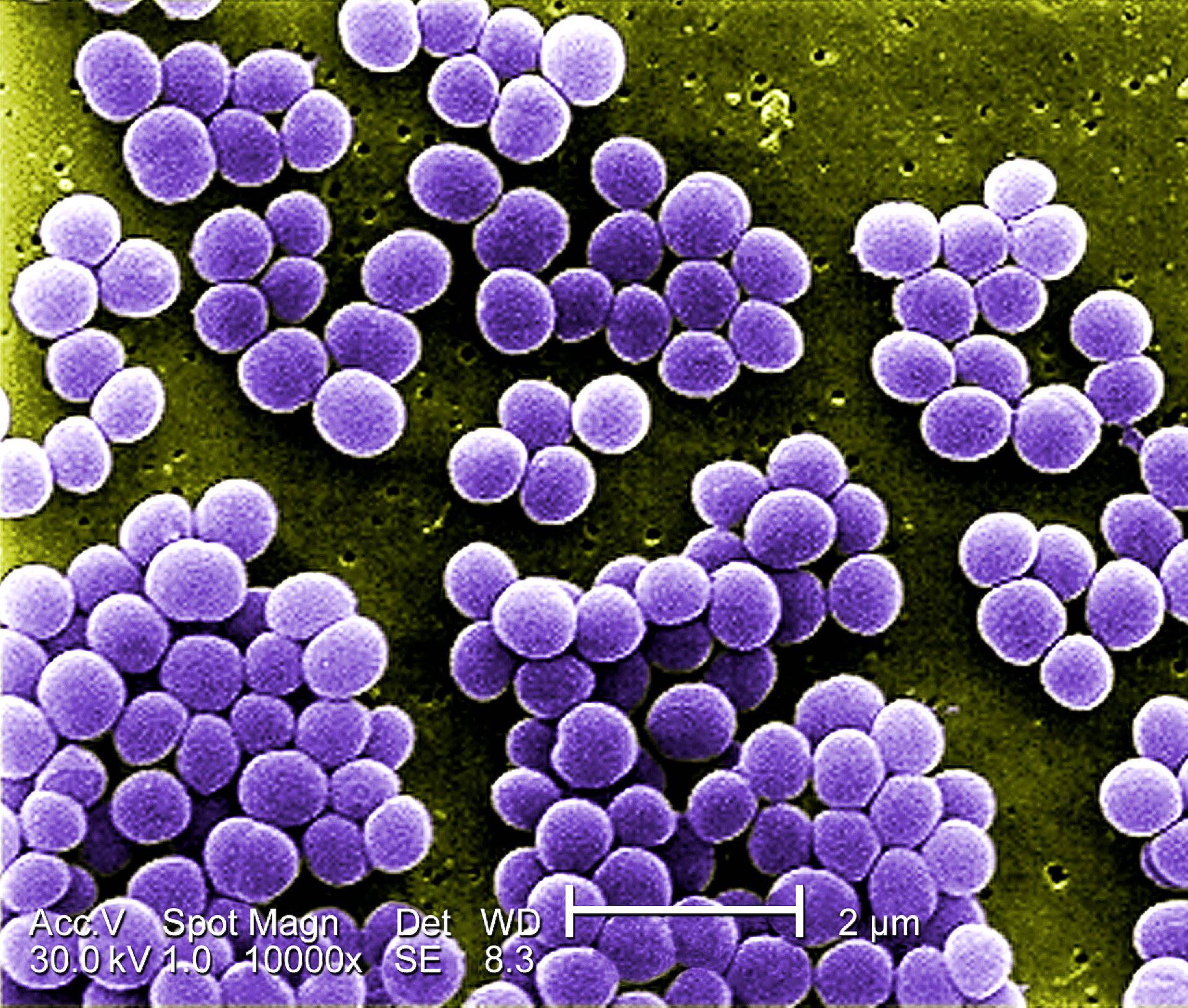 Under a high magnification of 10000x strain of staphylococcus au