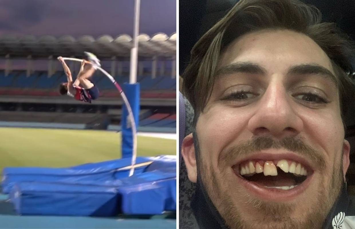 VIDEO Britanac dobio suvenir s Olimpijskih igara. Vlastiti zub
