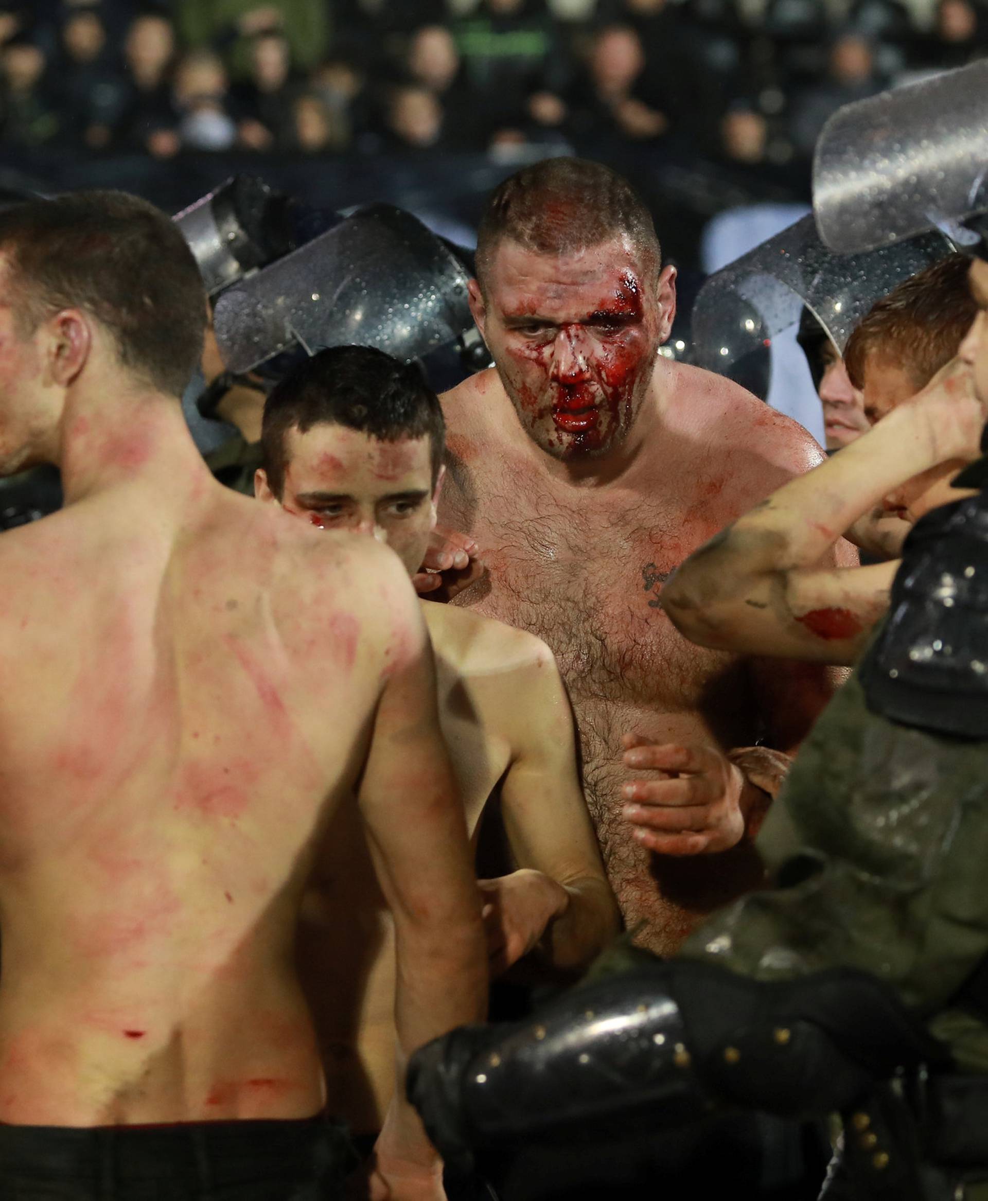 Police escort the soccer fans injured during the fights at a match between Red Star and Partizan in Belgrade