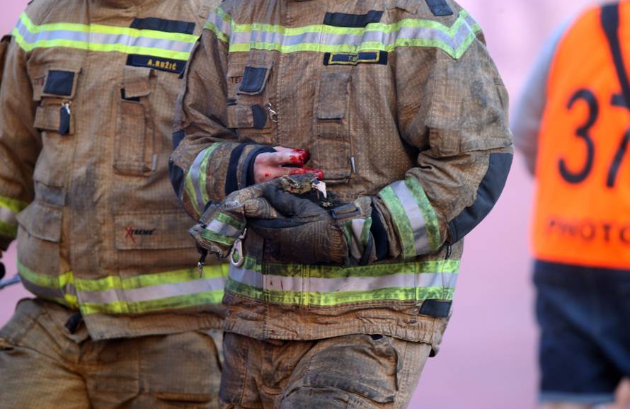 Strava na Poljudu! Vatrogascu topovski udar raznio dio prsta