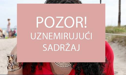 Ima novo lice: Žrtva doktora koji joj je ubrizgavao cement 