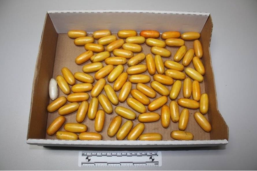 Ekskluzivne fotografije: Ovo je Brazilka koja je progutala kilu koke, doveli je u Veliku Goricu