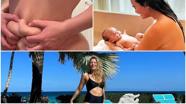 Tijela slavnih žena nakon poroda: Ponosno su pokazale strije, ožiljke, 'obješene' grudi