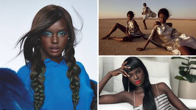 Zovu je 'crnom Barbie': Znali su mi se rugati zbog izgleda