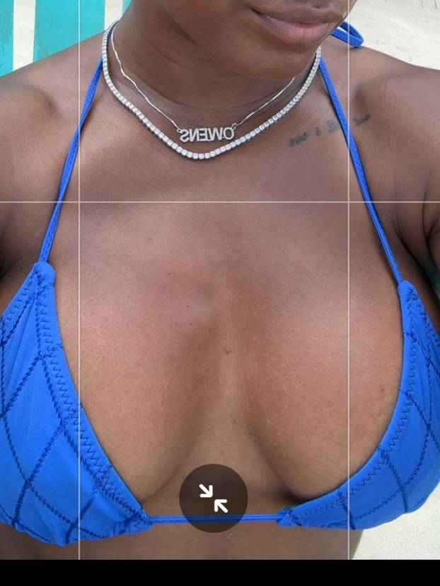 FOTO Simone Biles: Pogledajte mi grudi prije i poslije operacije