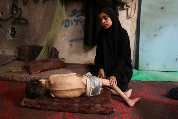 Displaced Palestinian mother Samah Matar sits next to her malnourished son Youssef, in Gaza City